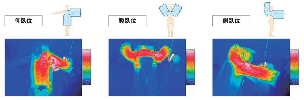 加温開始10分後の温度分布の一例